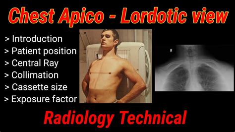 Chest (AP lordotic view) .
